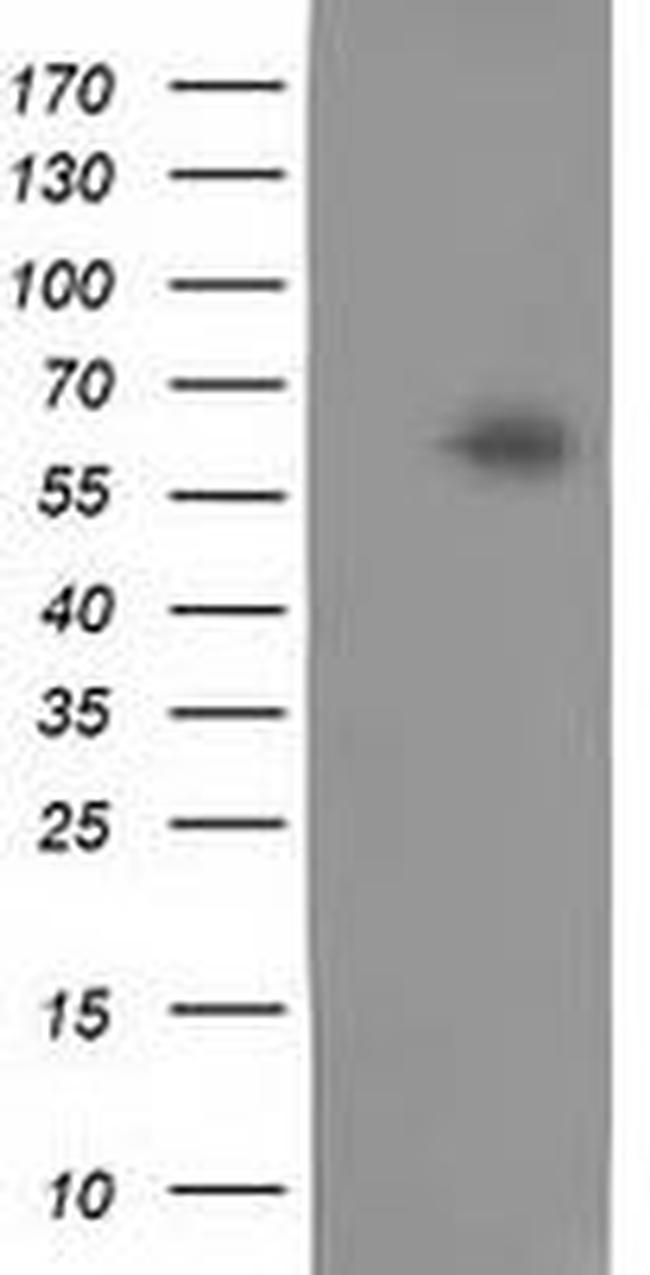 CALCOCO2 Antibody in Western Blot (WB)