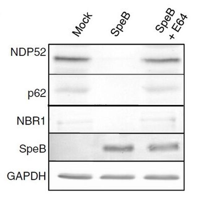 CALCOCO2 Antibody in Western Blot (WB)