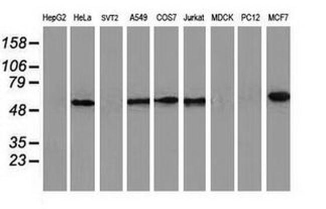 CALCOCO2 Antibody in Western Blot (WB)