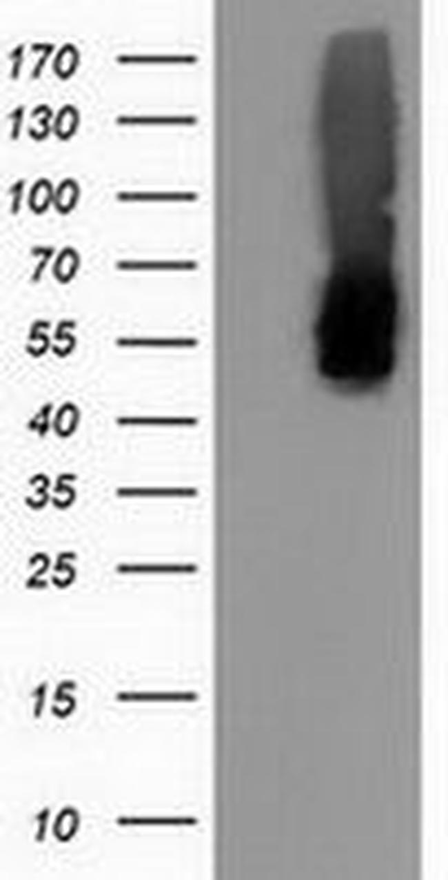 CALCOCO2 Antibody in Western Blot (WB)