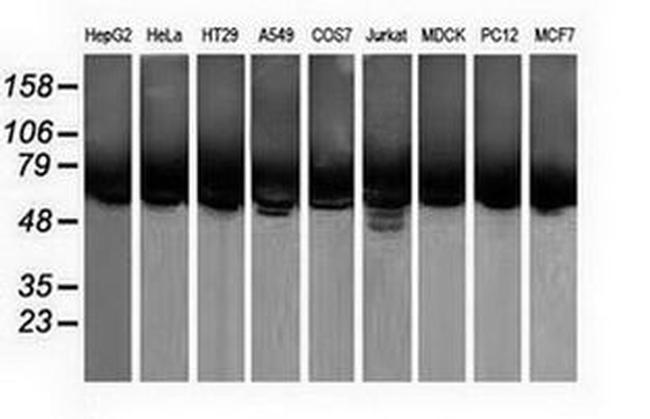 CALCOCO2 Antibody in Western Blot (WB)