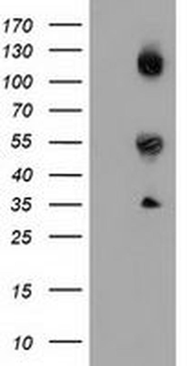 CALCOCO2 Antibody in Western Blot (WB)