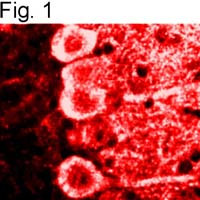 Calmodulin Antibody in Immunohistochemistry (IHC)