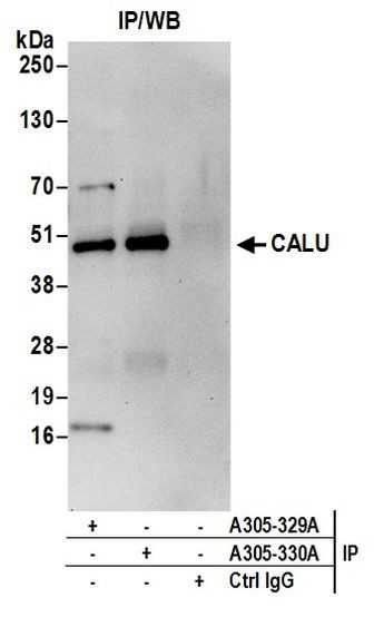 CALU Antibody in Immunoprecipitation (IP)