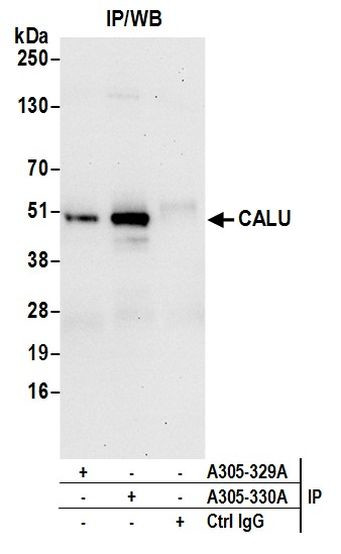 CALU Antibody in Immunoprecipitation (IP)