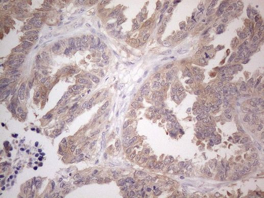 CAMK2B Antibody in Immunohistochemistry (Paraffin) (IHC (P))