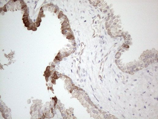 CAMK2B Antibody in Immunohistochemistry (Paraffin) (IHC (P))