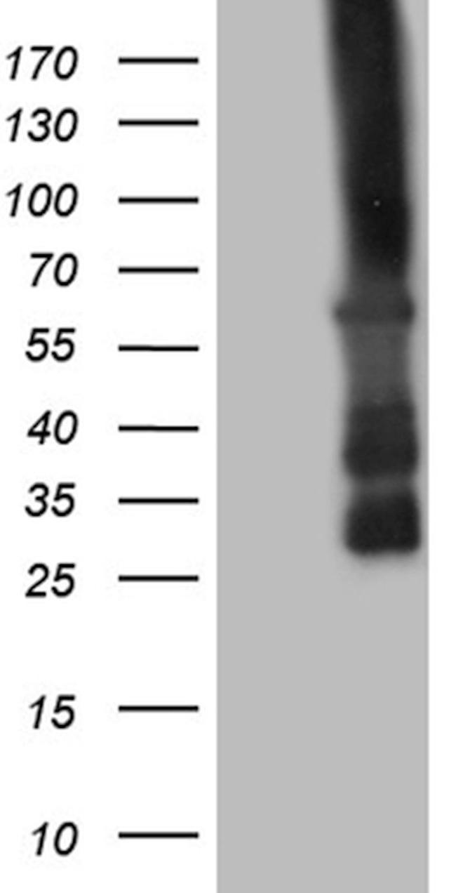 CAMK2B Antibody in Western Blot (WB)