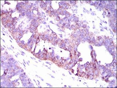 CaMKIV Antibody in Immunohistochemistry (Paraffin) (IHC (P))