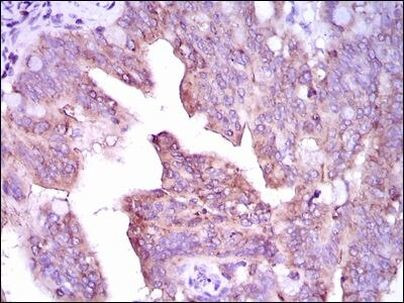 CaMKIV Antibody in Immunohistochemistry (Paraffin) (IHC (P))