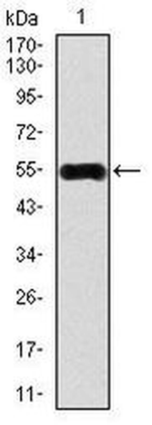 CaMKIV Antibody in Western Blot (WB)