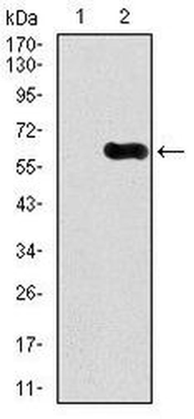 CaMKIV Antibody in Western Blot (WB)