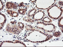 CAMLG Antibody in Immunohistochemistry (Paraffin) (IHC (P))