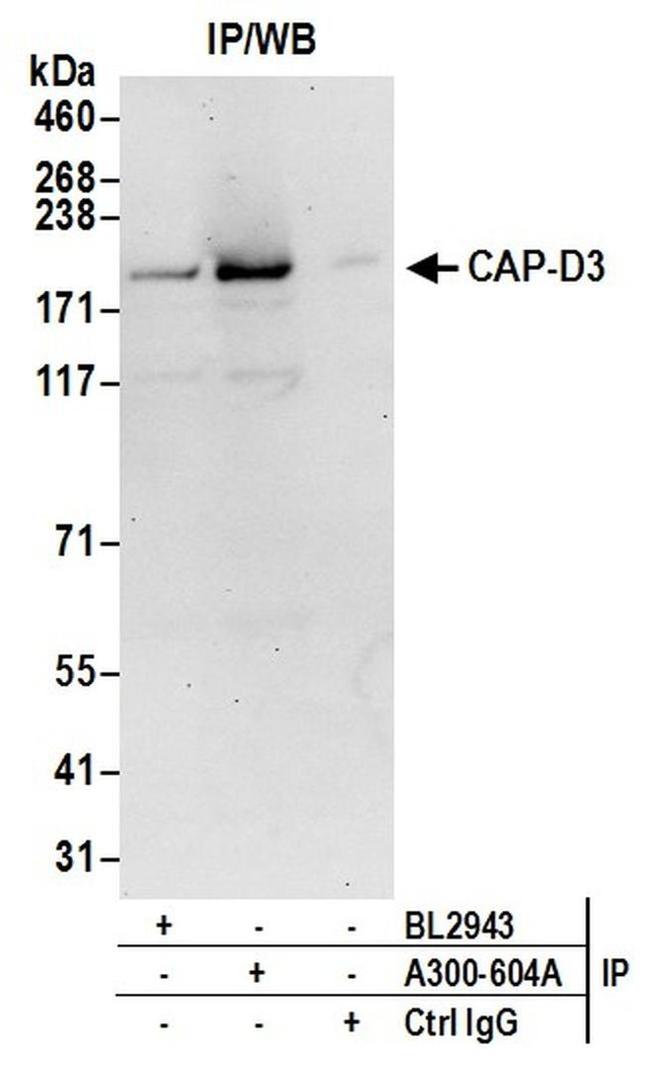 CAP-D3 Antibody in Western Blot (WB)