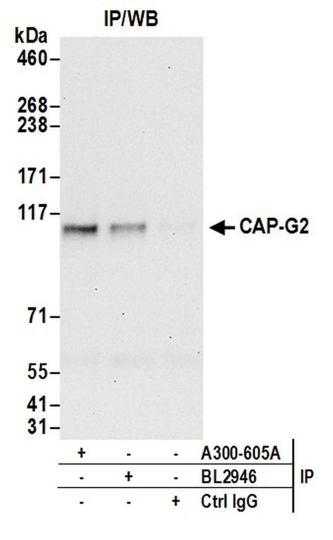 CAP-G2 Antibody in Western Blot (WB)