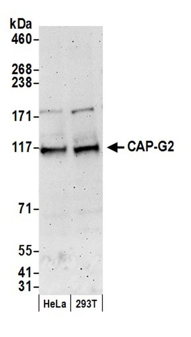 CAP-G2 Antibody in Western Blot (WB)