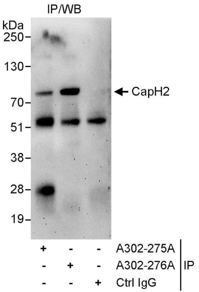 CAP-H2 Antibody in Immunoprecipitation (IP)