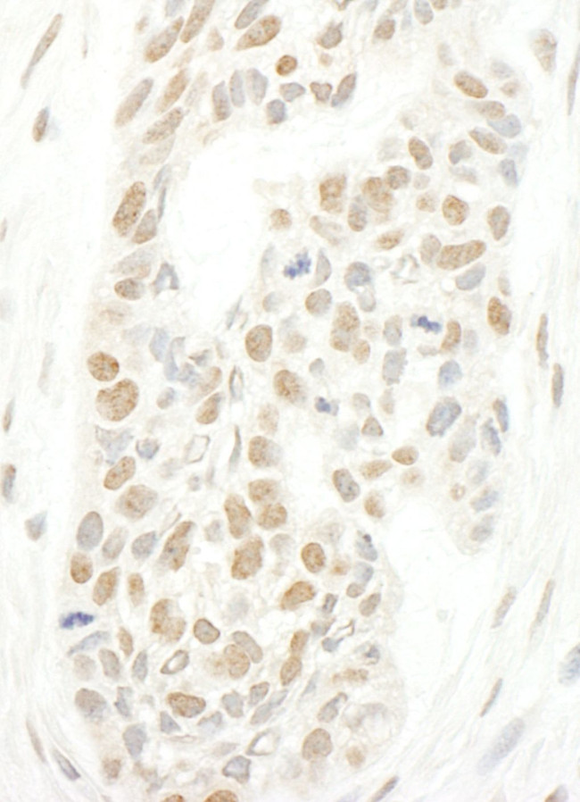 CAP-H2 Antibody in Immunohistochemistry (IHC)