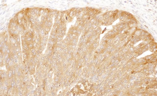 CAP1 Antibody in Immunohistochemistry (IHC)