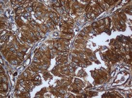 CAPN2 Antibody in Immunohistochemistry (Paraffin) (IHC (P))