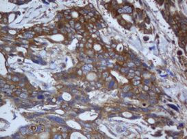 CAPN2 Antibody in Immunohistochemistry (Paraffin) (IHC (P))