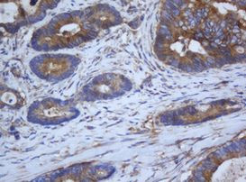 CAPN2 Antibody in Immunohistochemistry (Paraffin) (IHC (P))