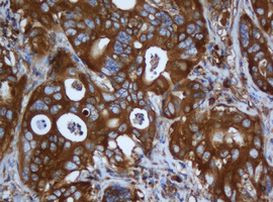 CAPN2 Antibody in Immunohistochemistry (Paraffin) (IHC (P))