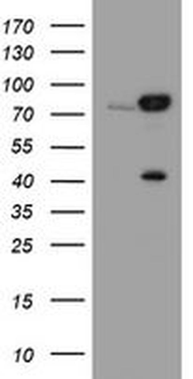 CAPN2 Antibody in Western Blot (WB)