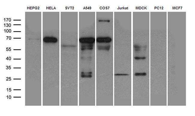 CAPN2 Antibody in Western Blot (WB)