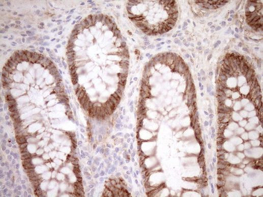 CAPN5 Antibody in Immunohistochemistry (Paraffin) (IHC (P))