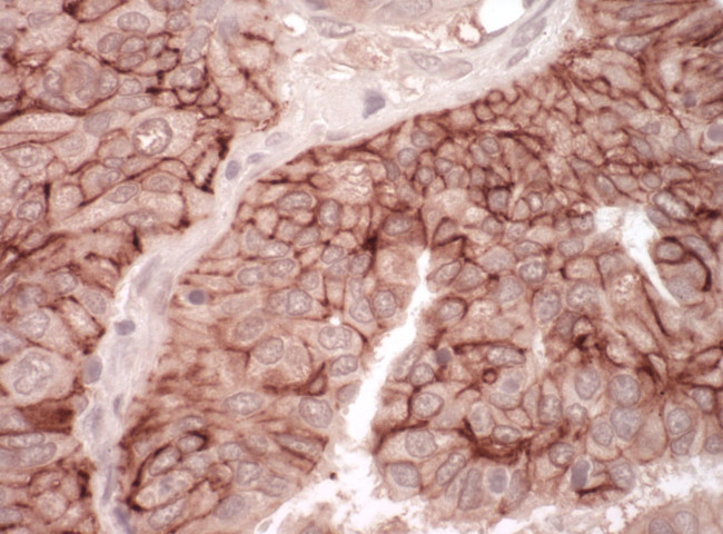 CAR Antibody in Immunohistochemistry (IHC)