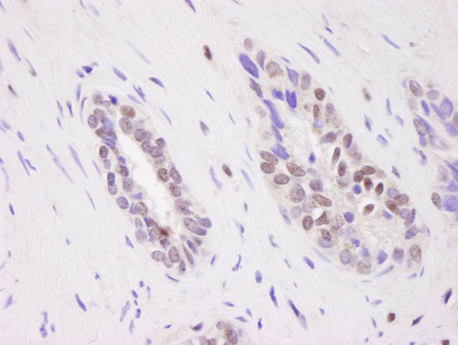 CARM1 Antibody in Immunohistochemistry (IHC)