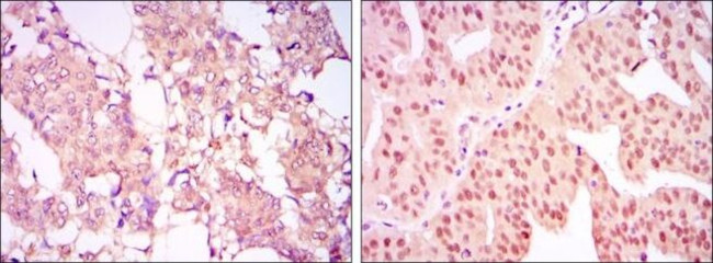 PRMT4 Antibody in Immunohistochemistry (Paraffin) (IHC (P))