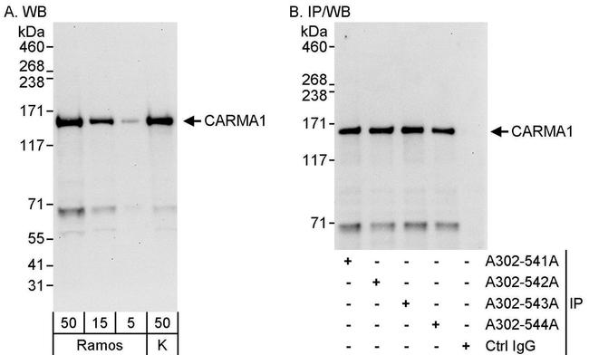 CARMA1 Antibody in Western Blot (WB)