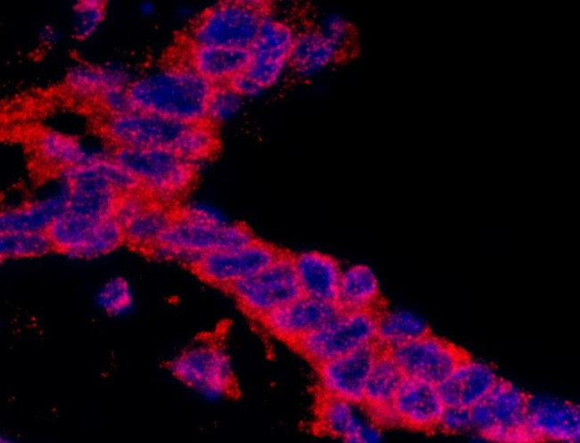 CASC3 Antibody in Immunohistochemistry (IHC)