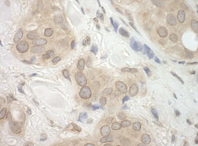 CASC3 Antibody in Immunohistochemistry (IHC)