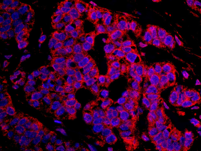 CASC3 Antibody in Immunohistochemistry (IHC)