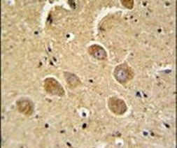 Caspase 3 (Cleaved Asp175) Antibody in Immunohistochemistry (IHC)