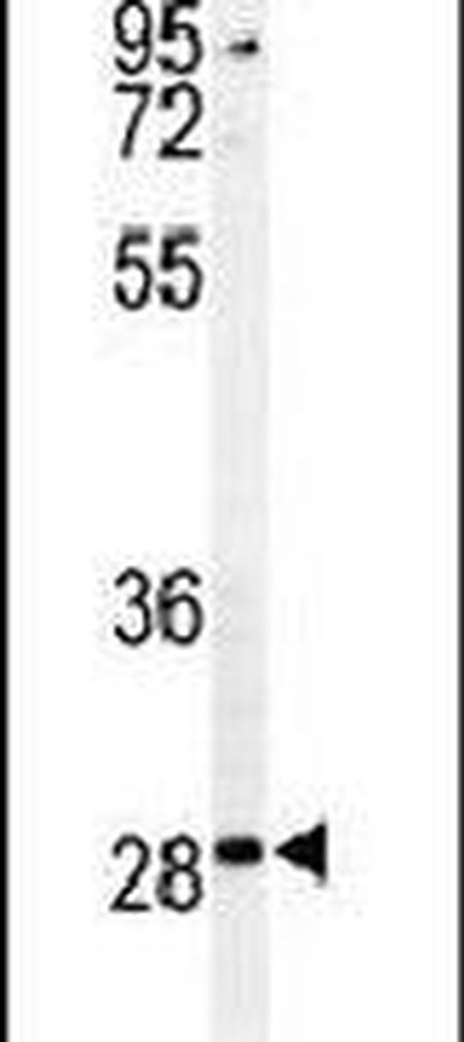 Caspase 3 (Cleaved Asp175) Antibody in Western Blot (WB)