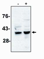 Caspase 7 Antibody in Western Blot (WB)