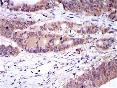 Caspase 8 Antibody in Immunohistochemistry (Paraffin) (IHC (P))