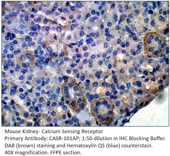 Calcium Sensing Receptor Antibody in Immunohistochemistry (IHC)