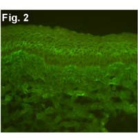 Calcium Sensing Receptor Antibody in Immunohistochemistry (IHC)