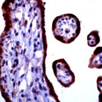 Calcium Sensing Receptor Antibody in Immunohistochemistry (Paraffin) (IHC (P))