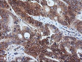 CAST Antibody in Immunohistochemistry (Paraffin) (IHC (P))