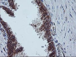 CAST Antibody in Immunohistochemistry (Paraffin) (IHC (P))