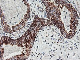 CAST Antibody in Immunohistochemistry (Paraffin) (IHC (P))