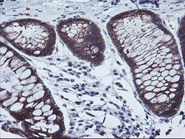 CAST Antibody in Immunohistochemistry (Paraffin) (IHC (P))