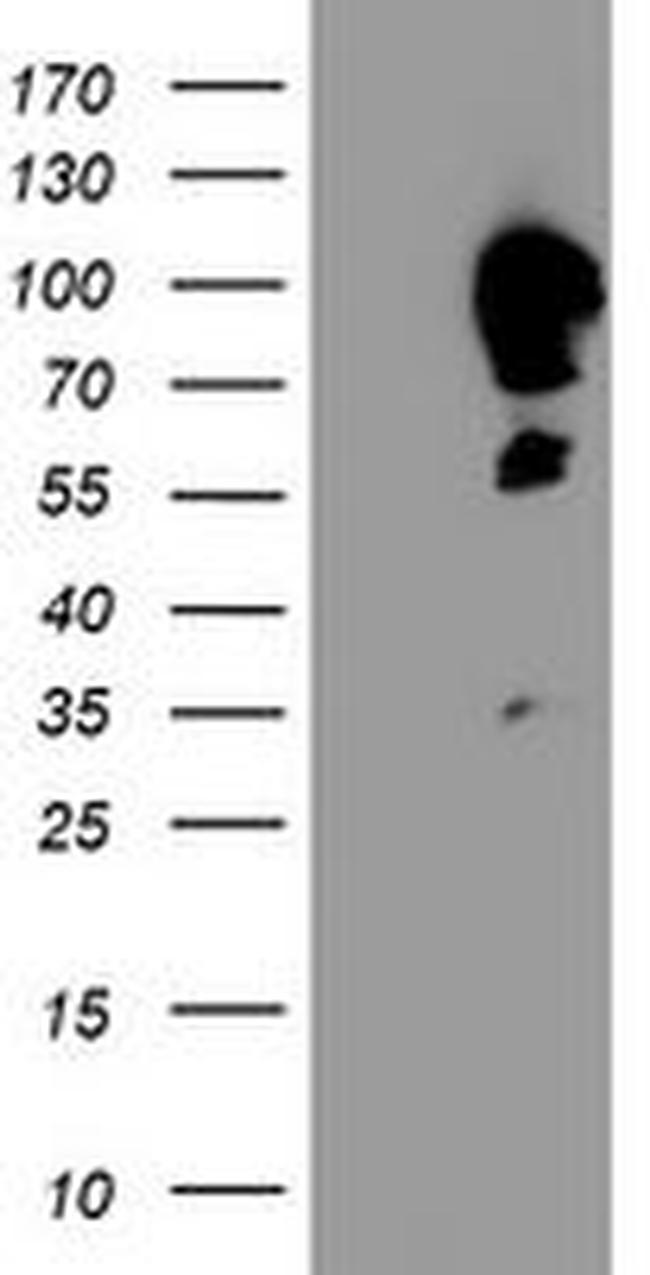 CAST Antibody in Western Blot (WB)