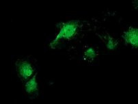 CAT Antibody in Immunocytochemistry (ICC/IF)